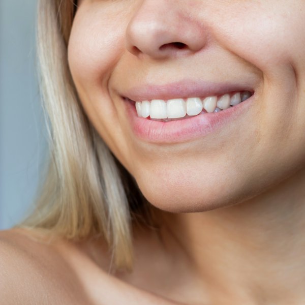 Smile-Dimple-2025882713